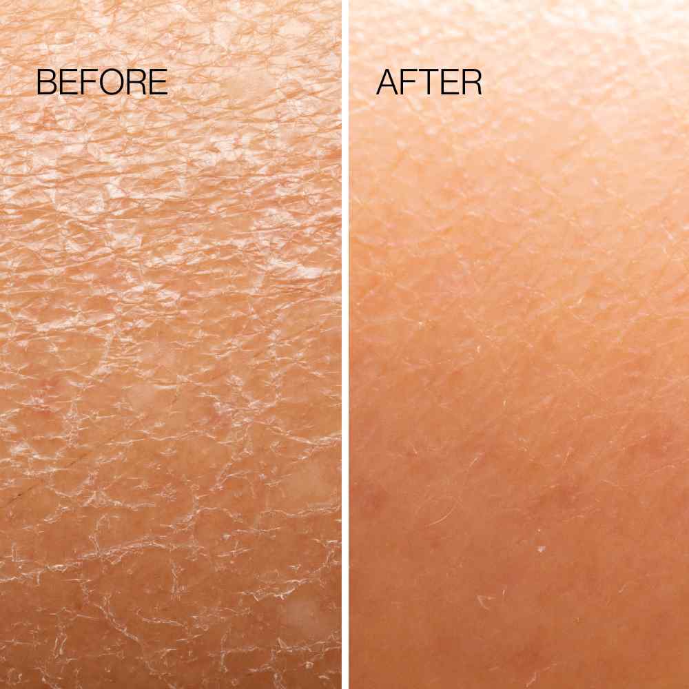 Body Plane Exfoliator Tool Esker