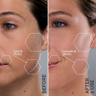 Spa Sciences SIMA Deluxe Sonic Dermaplaning Tool for Exfoliation & Peach Fuzz Removal - Imperfect Box This is Beauty US