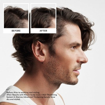 Nioxin System 2 Hair Thickening Natural & Untreated Hair Shampoo & Conditioner Kit 3ct - New This is Beauty US