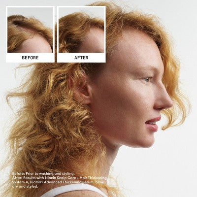 Nioxin System 4 Hair Thickening Colored & Damaged Hair Shampoo & Conditioner Kit 3ct - NEW This is Beauty US