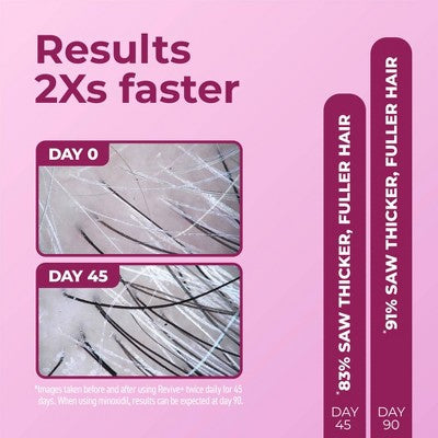 BosleyMD Revive + Densifying Hair Regrowth Serum for Women 1 fl oz - Missing Box This is Beauty US