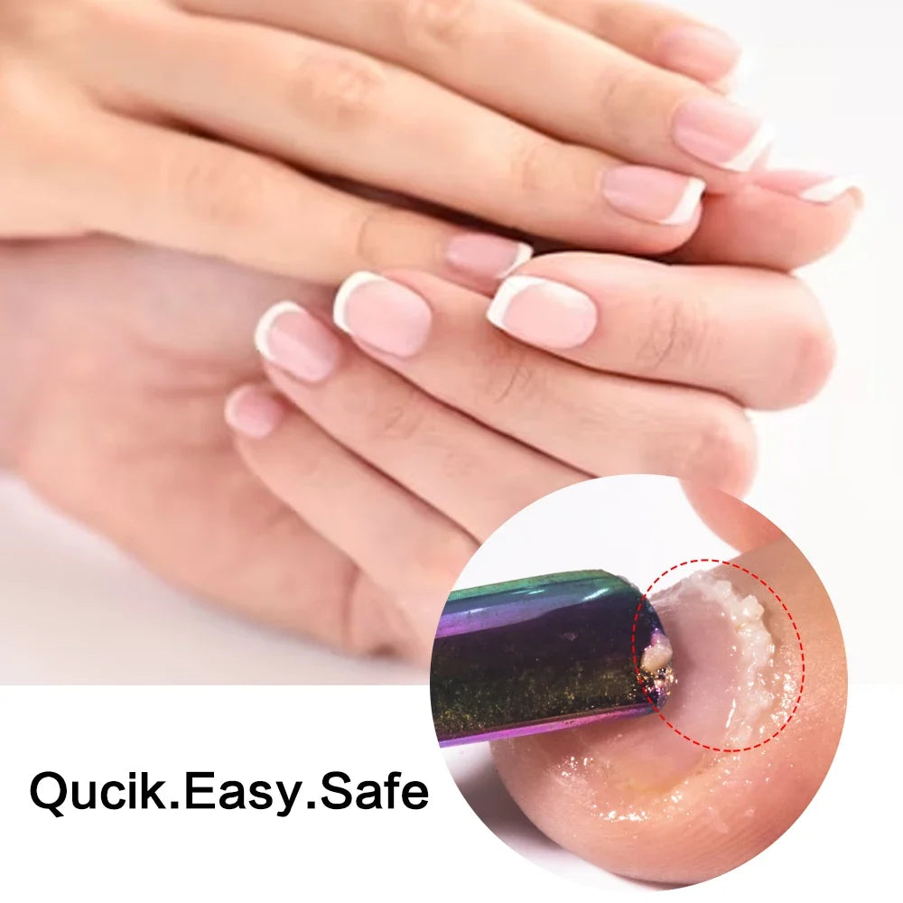 KODIES GEL Cuticle Remover 15ML Gentle Exfoliator Foot Cuticle Oil Softener Liquid Nail Art Treatment Manicure Repair Care Tools Blushimmer