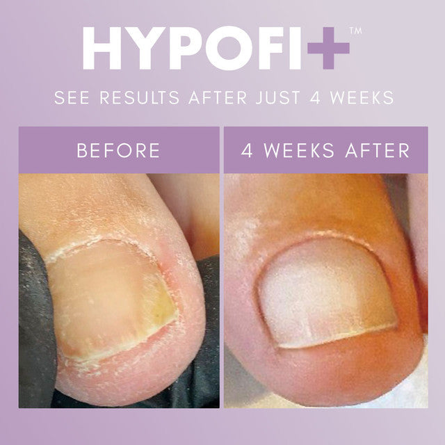 HypoFix™ Primer - 20ml Lunali Nail Supply