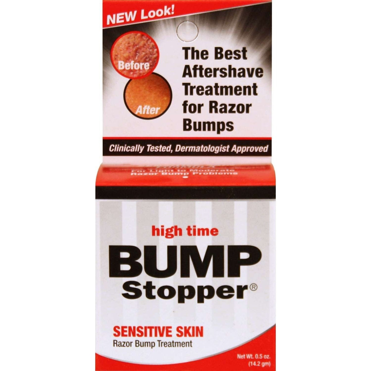 Bump Stopper Razor Bump Treatment  Sensitive Skin Care Formula My Beauty Site Pro